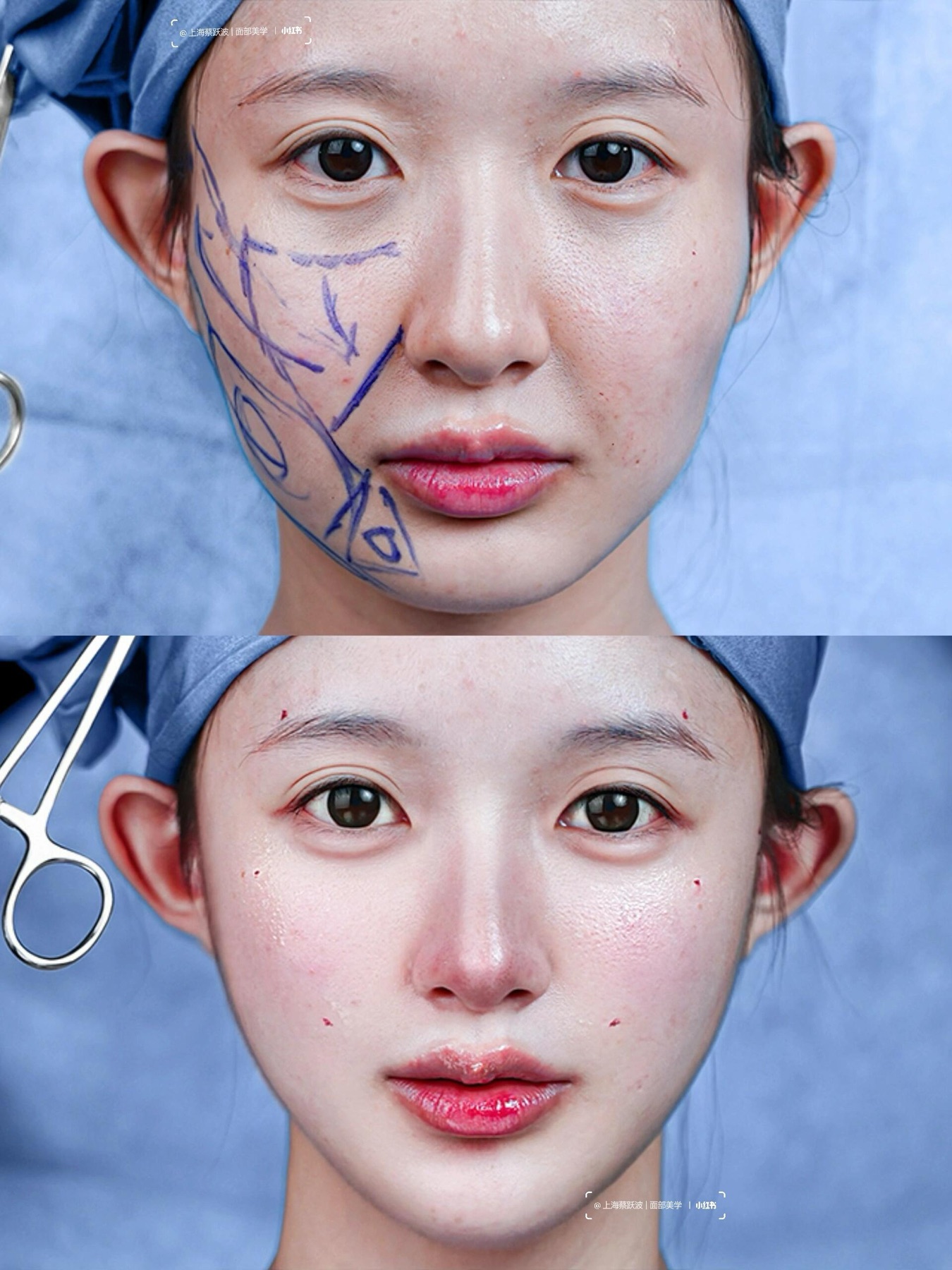 Consented Baby Face case 40