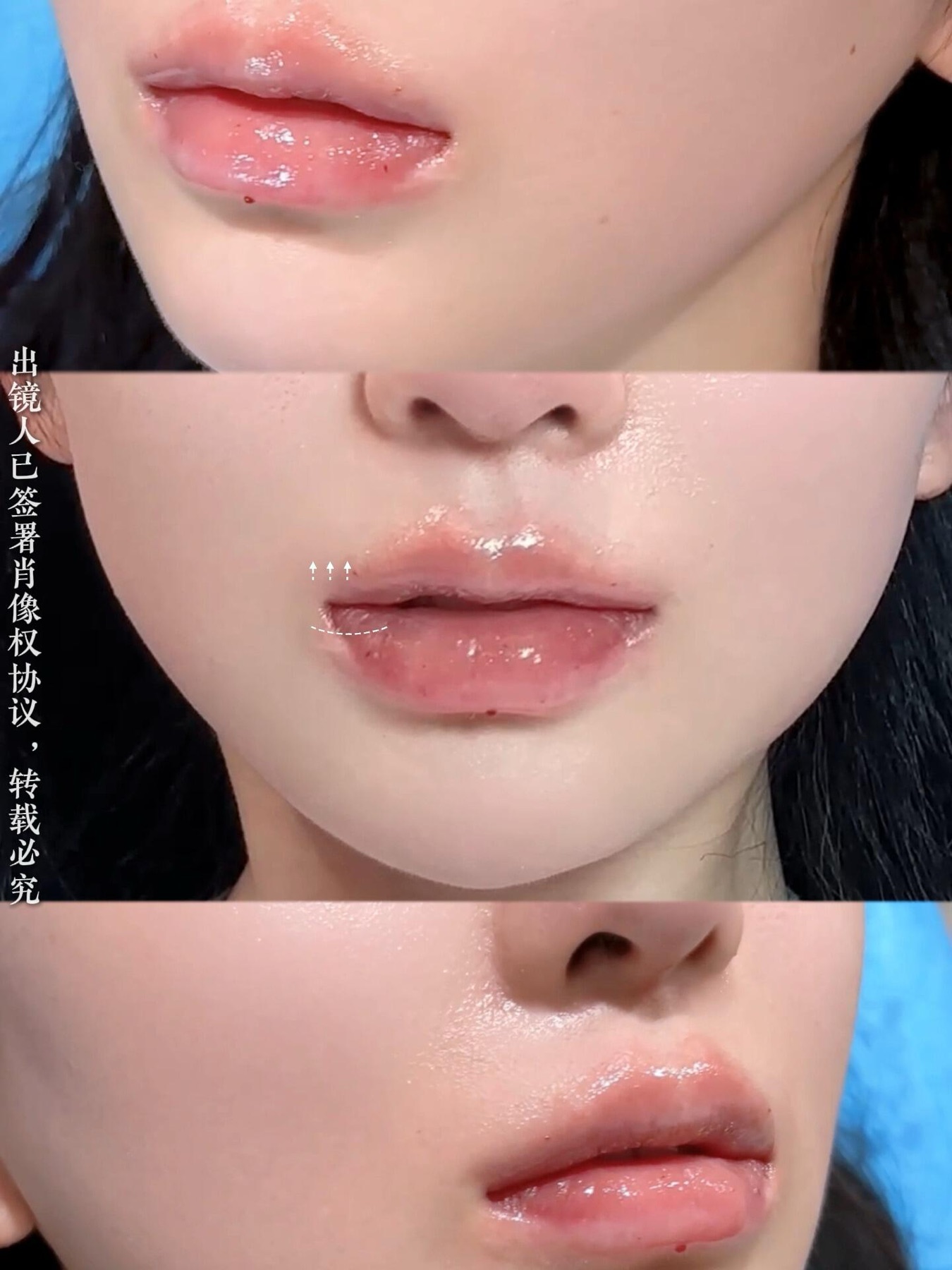 Consented Baby Face case 31