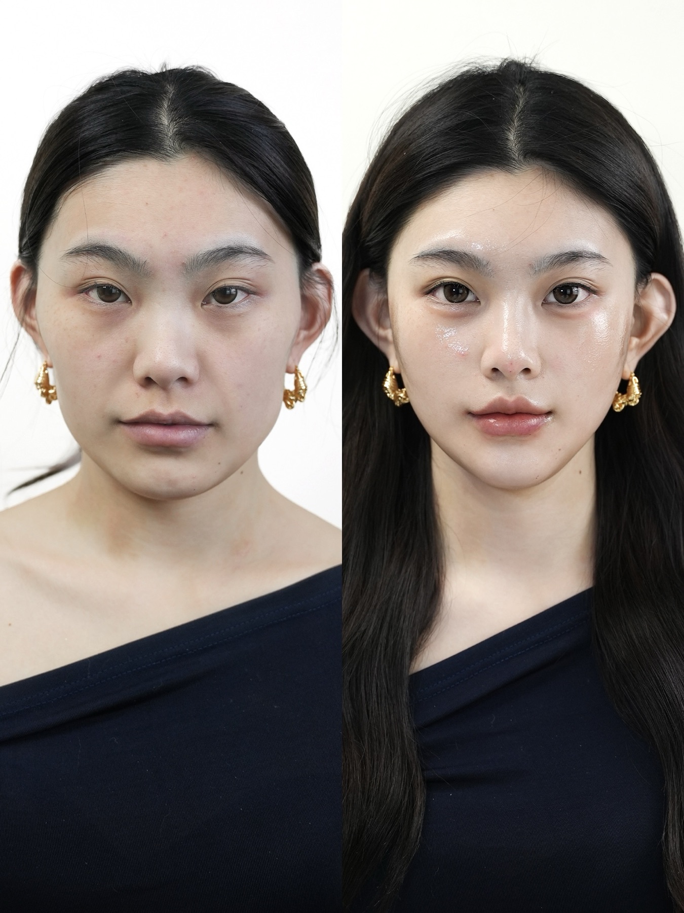 Consented Baby Face case 02