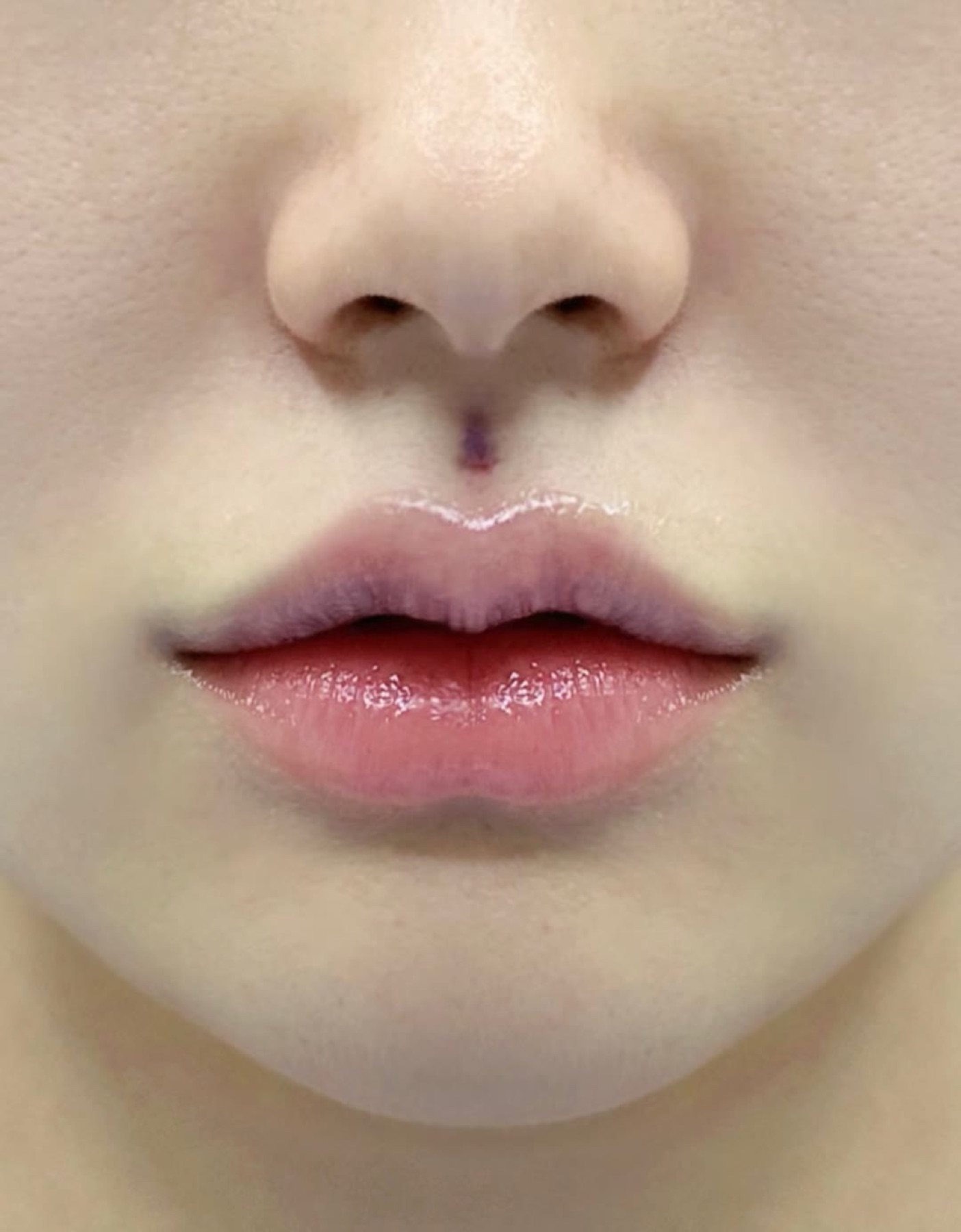 Consented Baby Face case 22