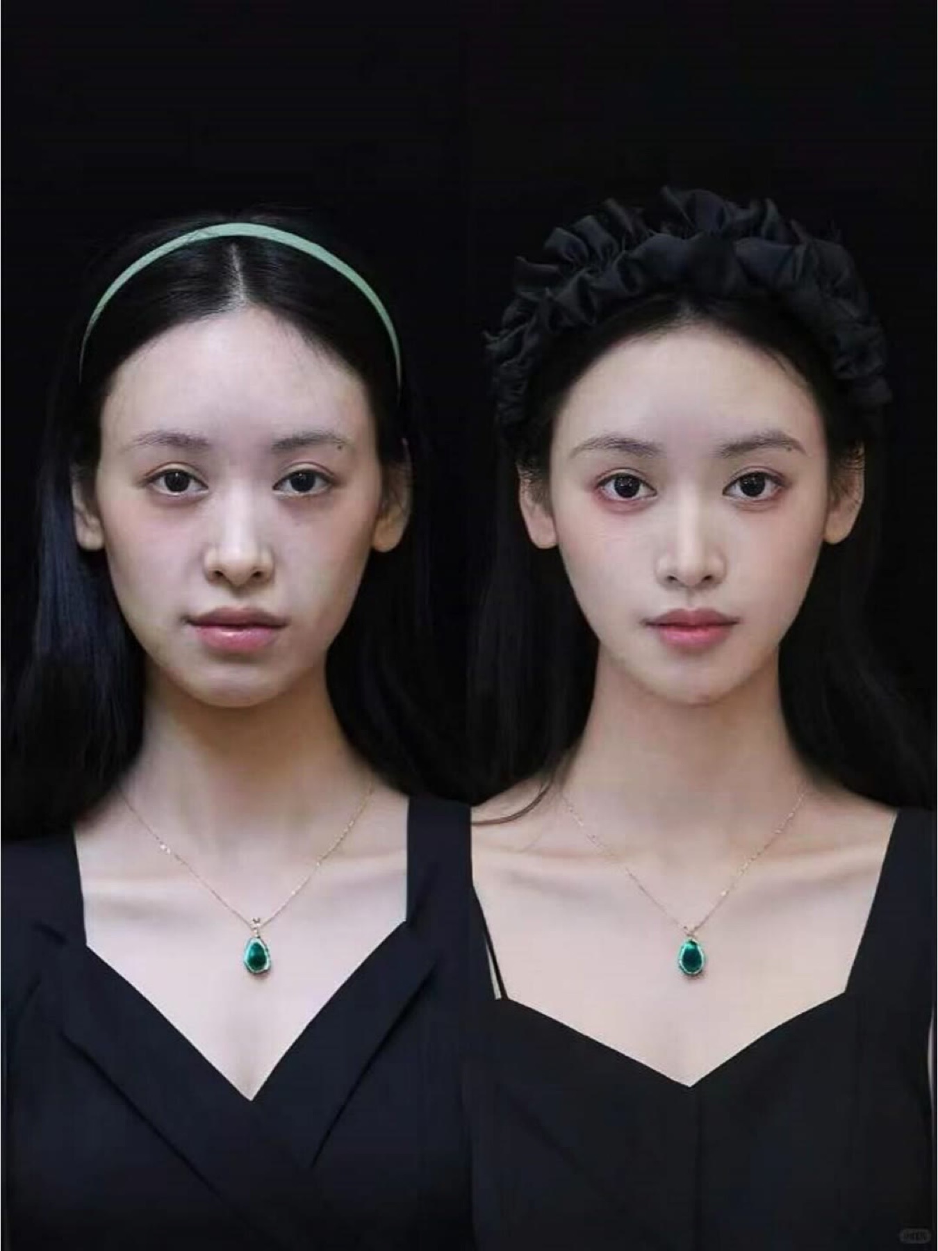 Consented Baby Face case 25