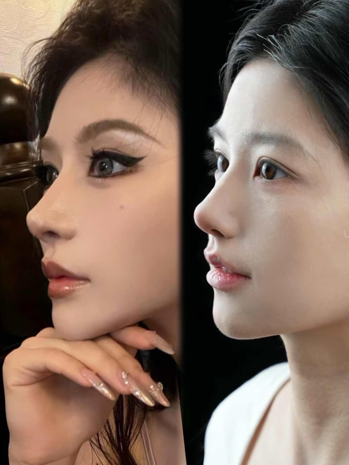 Consented Baby Face case 41