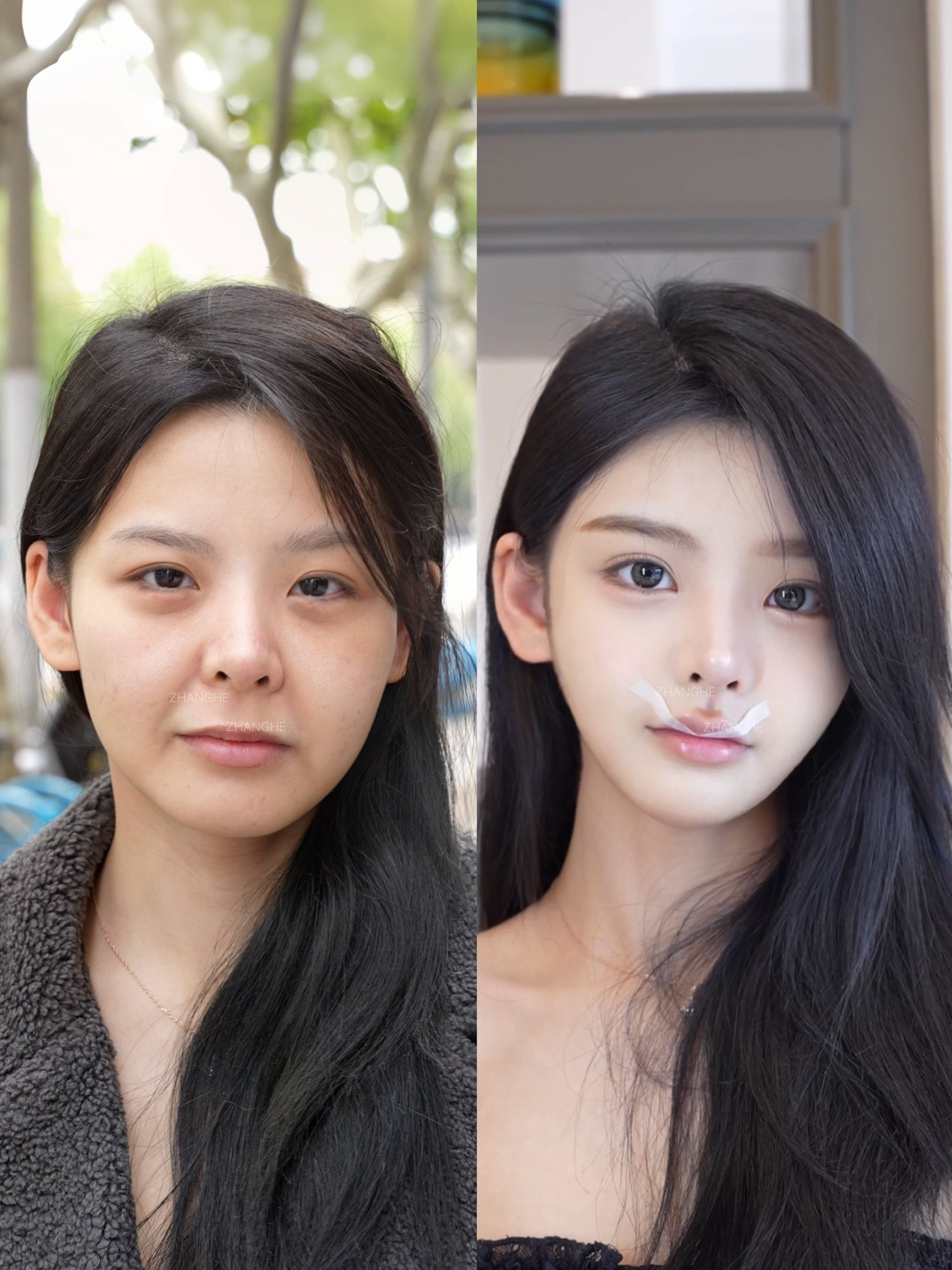 Consented Baby Face case 12