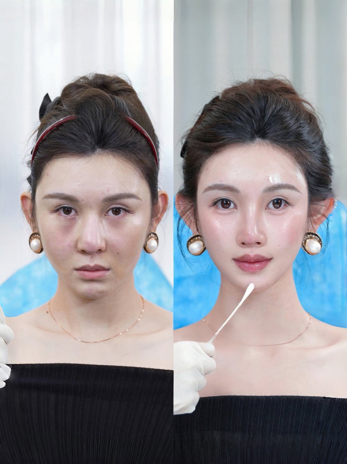 Consented Baby Face case 33