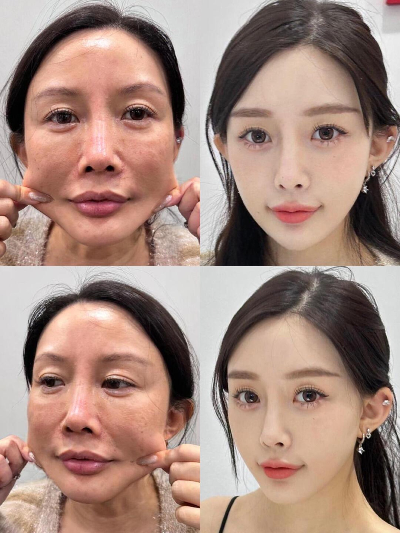 Consented Baby Face case 30