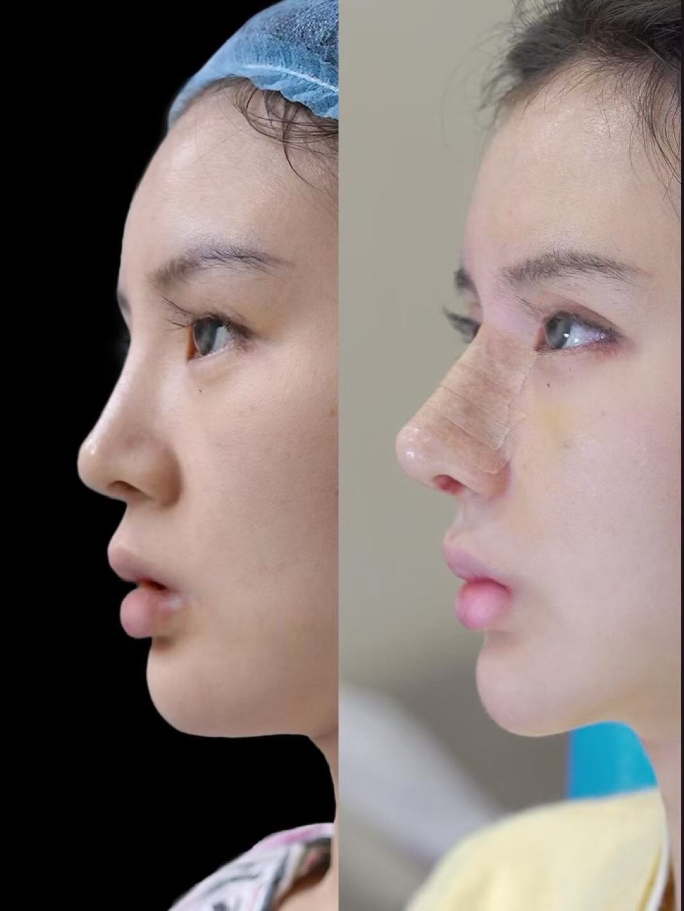 Consented Baby Face case 48