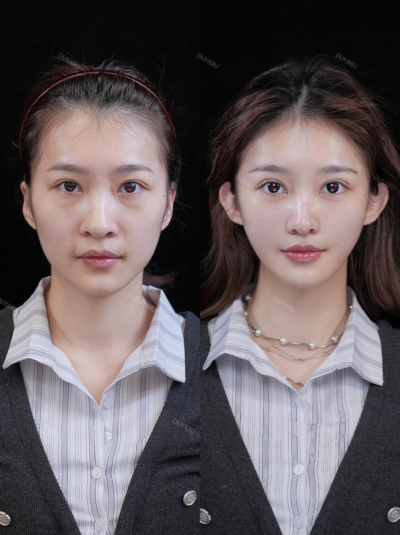 Consented Baby Face case 43