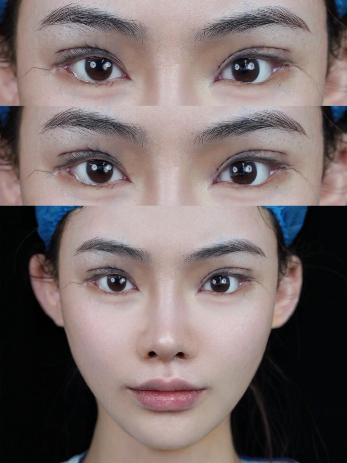 Consented Baby Face case 50