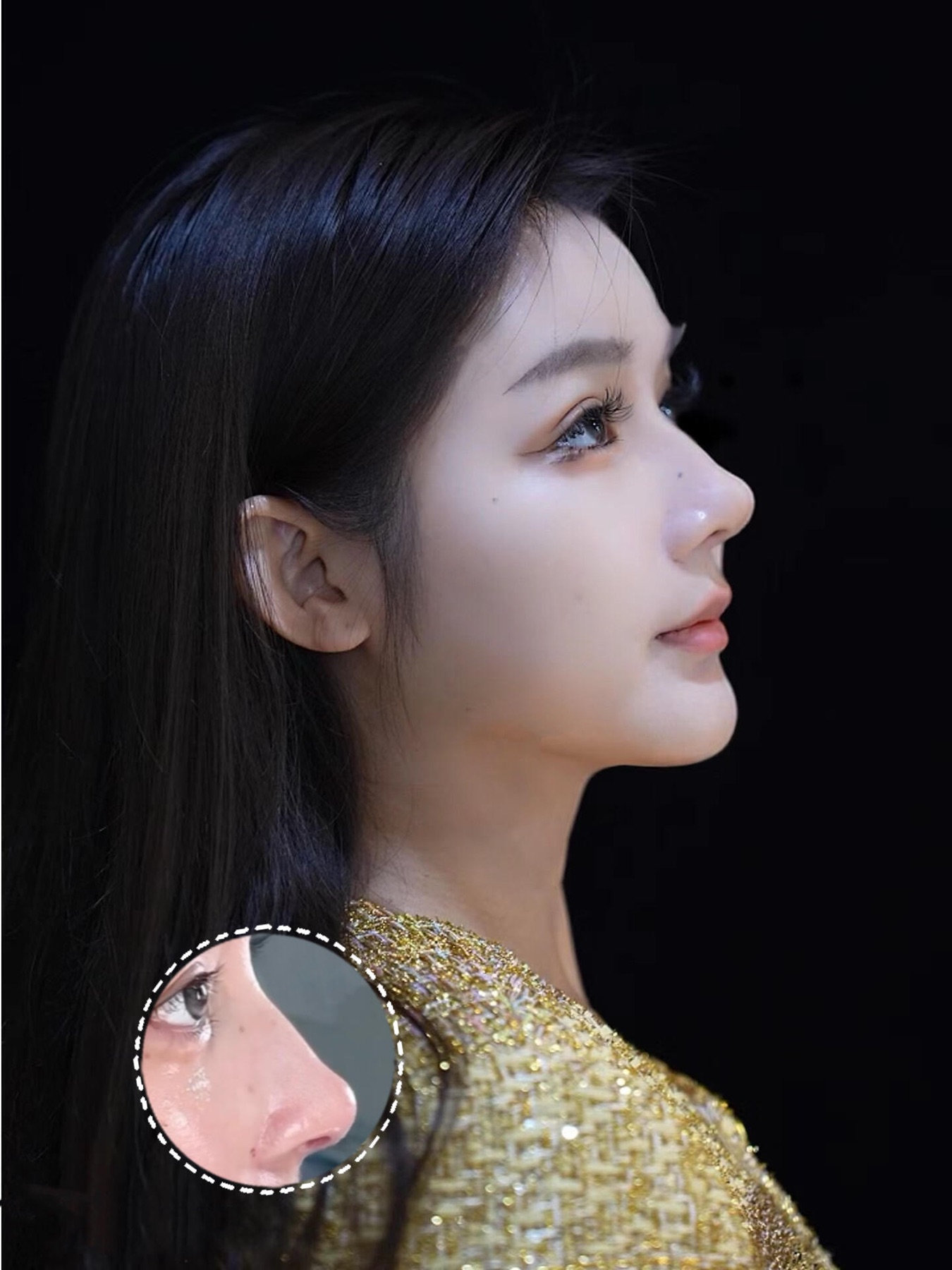 Consented Baby Face case 26