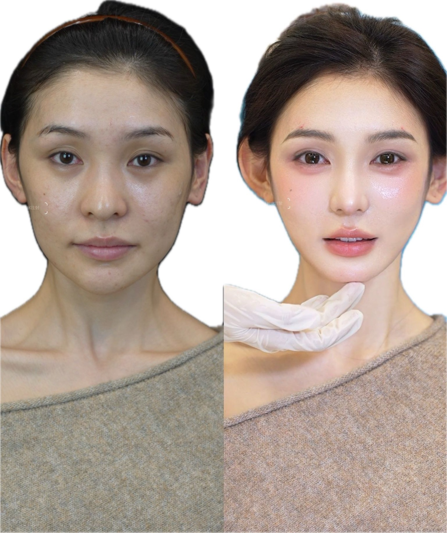 Consented Baby Face case 37