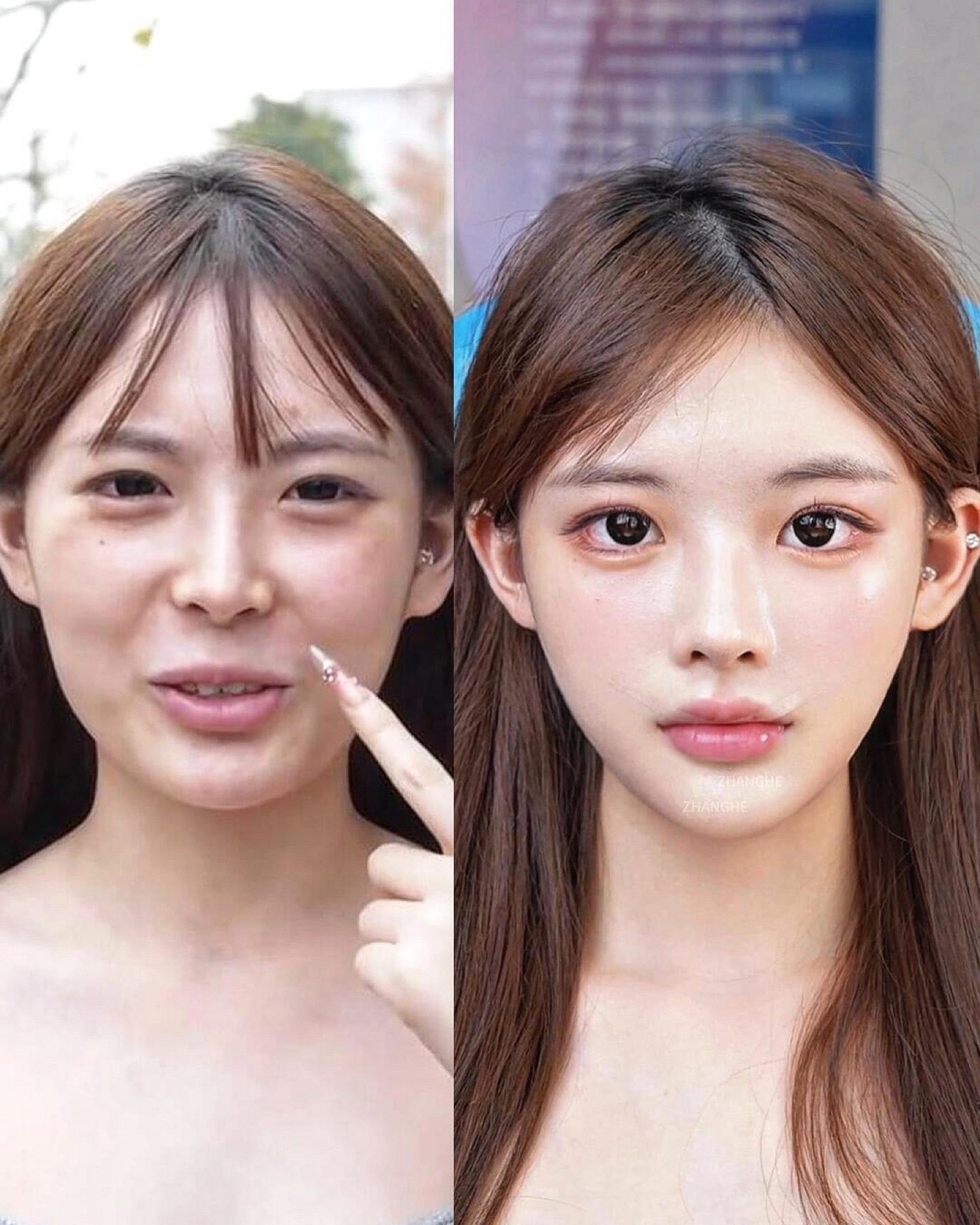 Consented Baby Face case 24