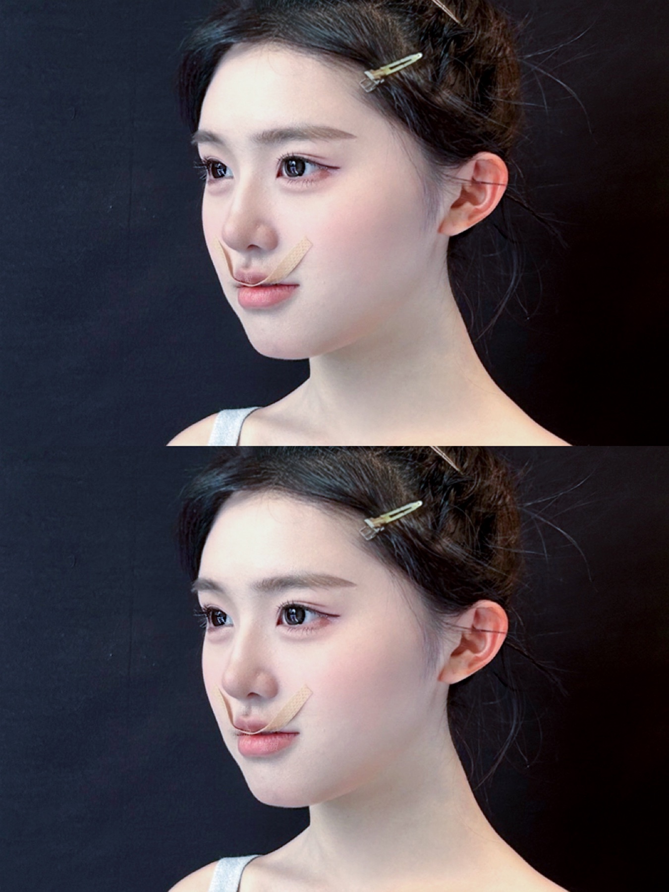 Consented Baby Face case 03