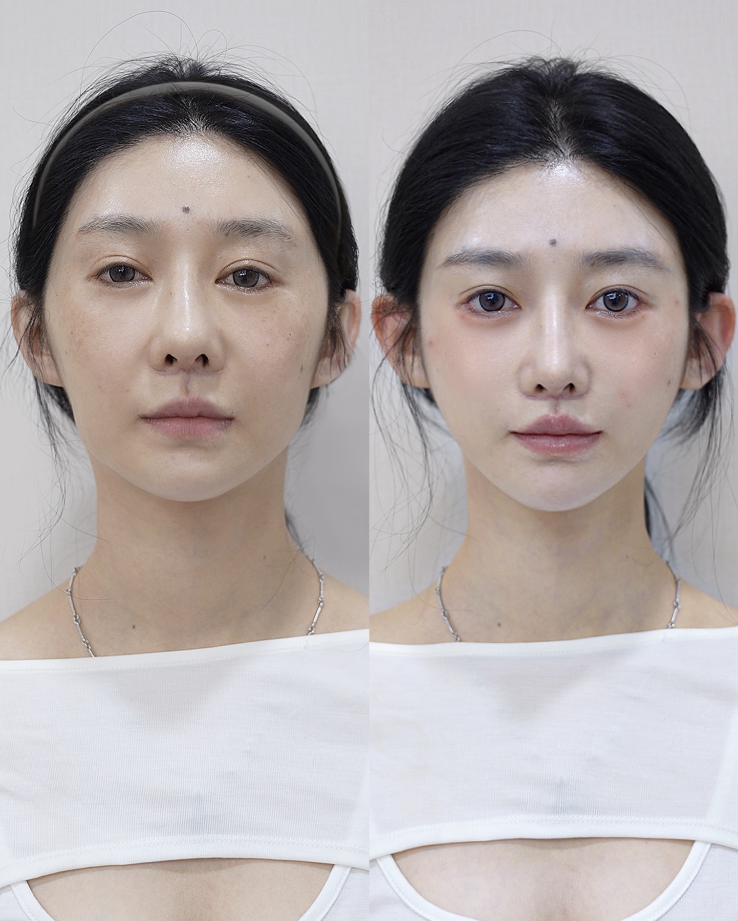 Consented Baby Face case 01