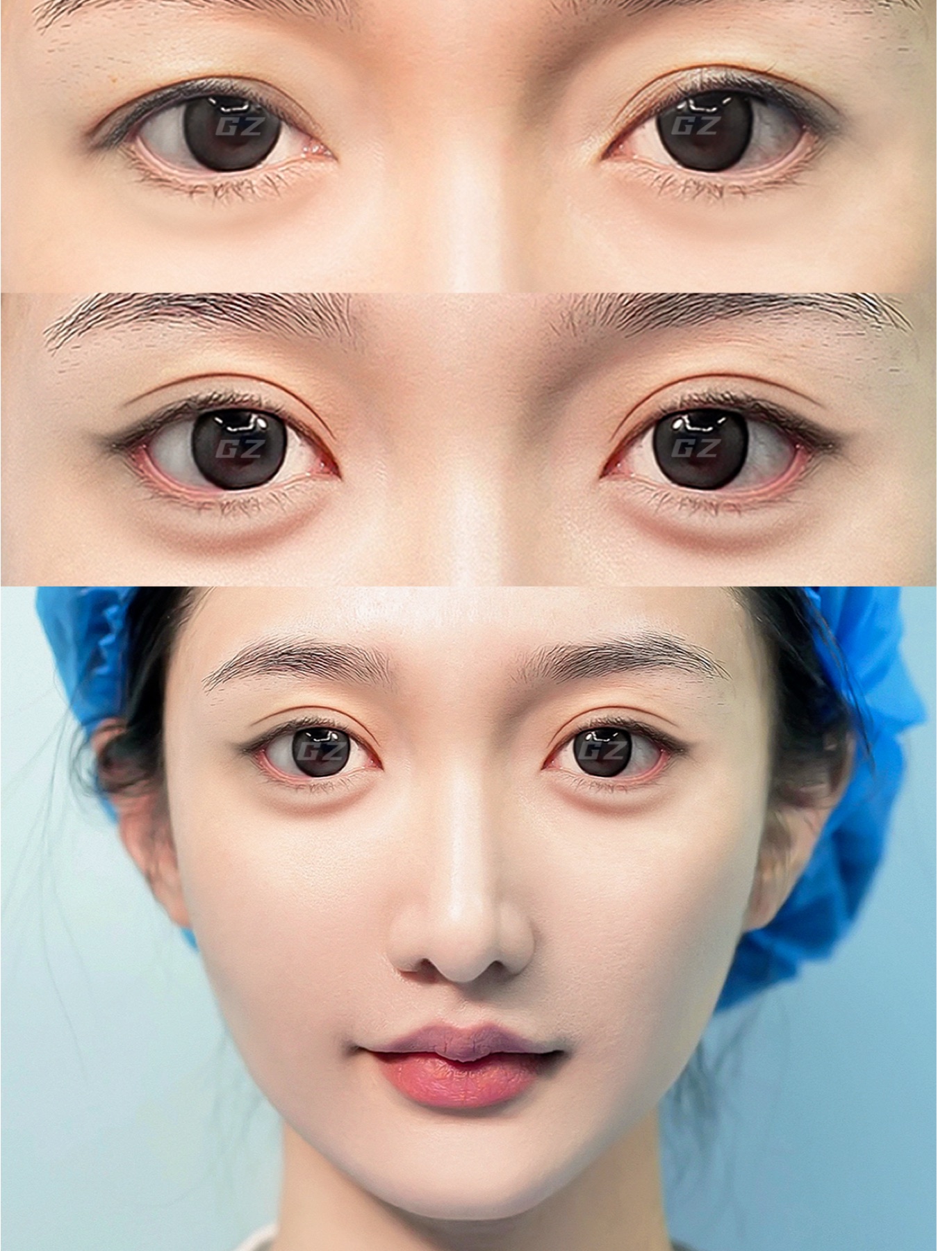 Consented Baby Face case 54