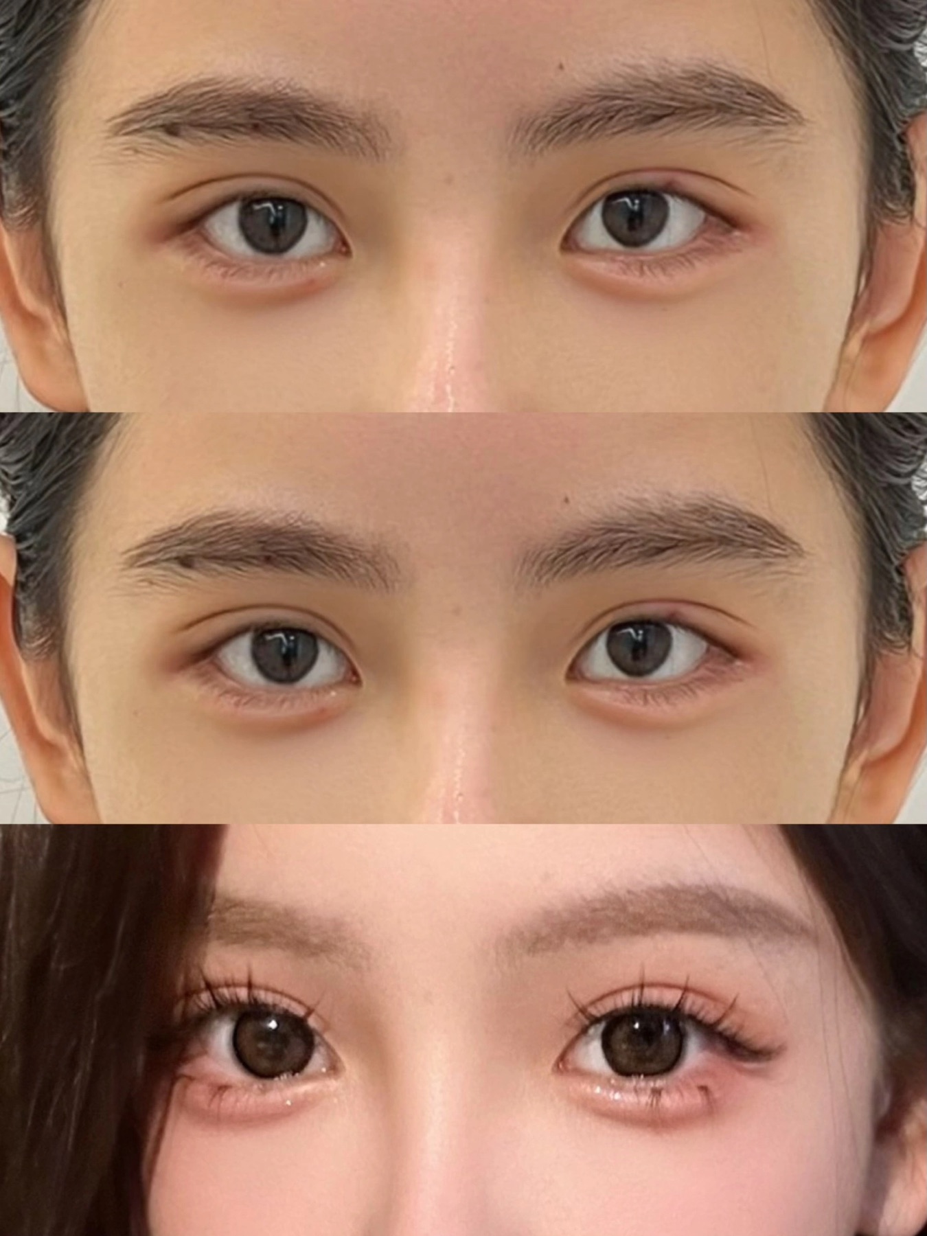 Consented Baby Face case 07