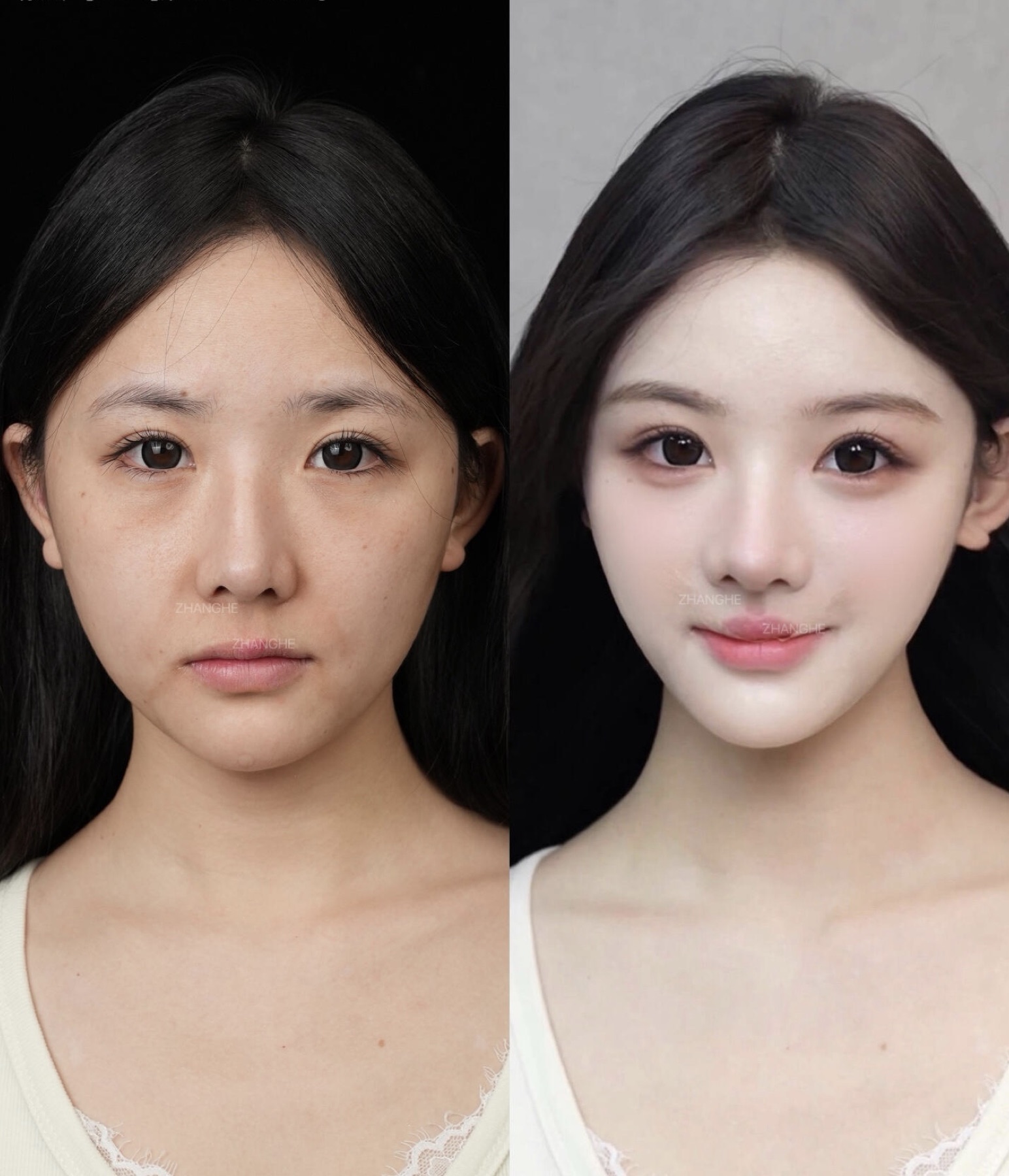 Consented Baby Face case 42