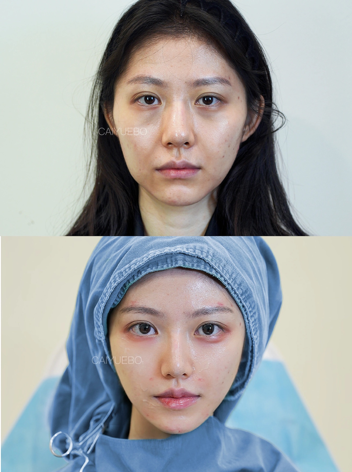 Consented Baby Face case 18