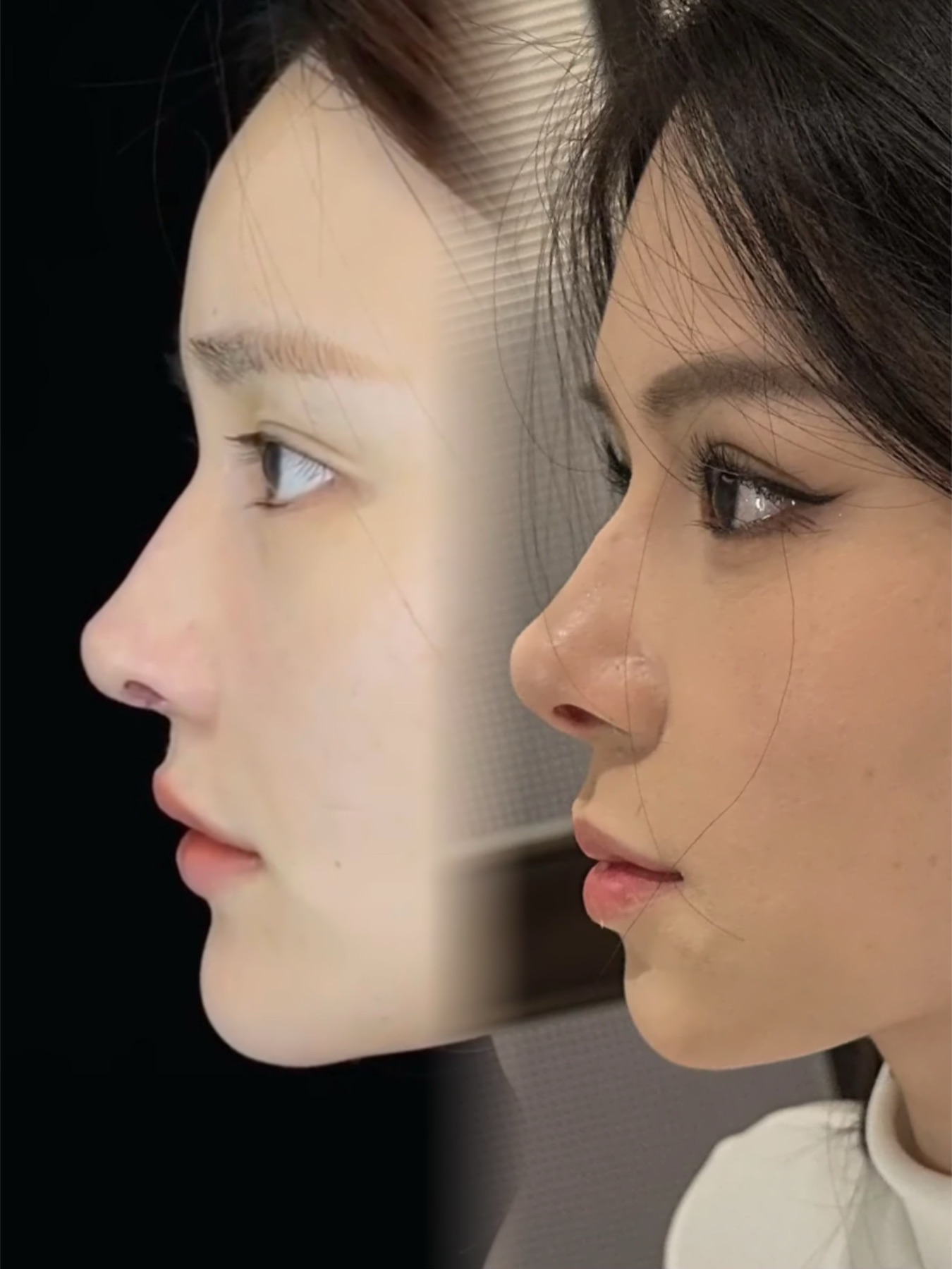 Consented Baby Face case 19