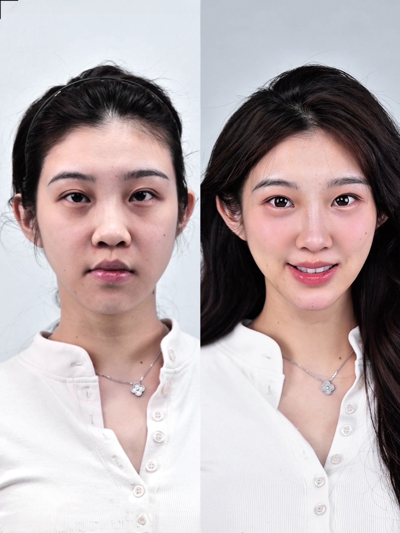 Consented Baby Face case 17