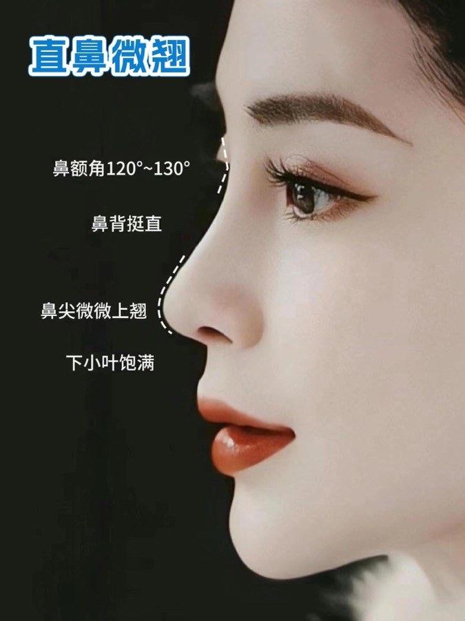 Historical facial lifting and Baby Face case 05