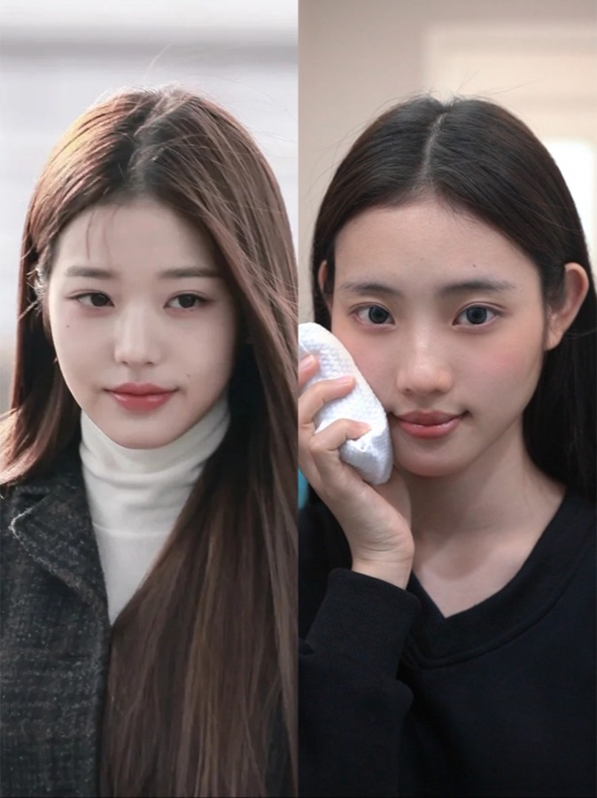 Historical facial lifting and Baby Face case 06