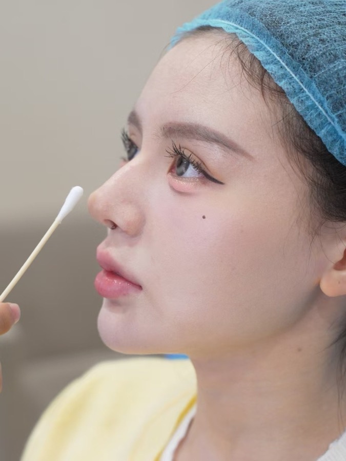 Historical facial lifting and Baby Face case 04
